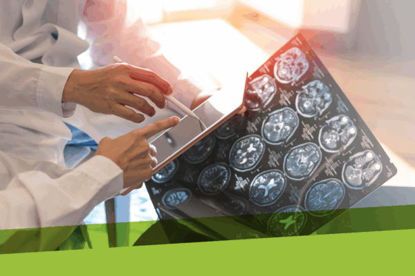 A healthcare professional reviewing brain scan images on a tablet for diagnosis or treatment plannin.