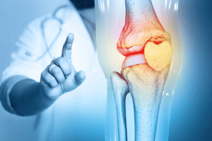 doctor pointing at knee bone imaging